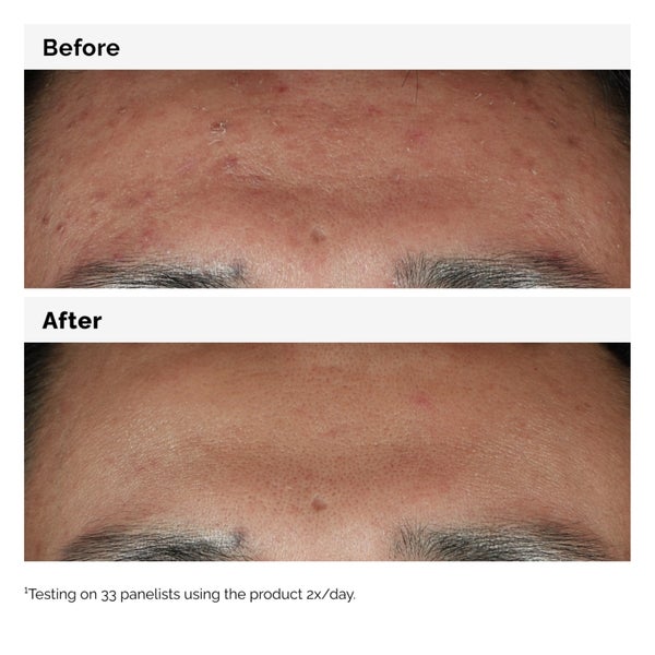 The Ordinary The Ordinary Niacinamide 10% + Zinc 1% Serum 30ml Prezzo Ridotto