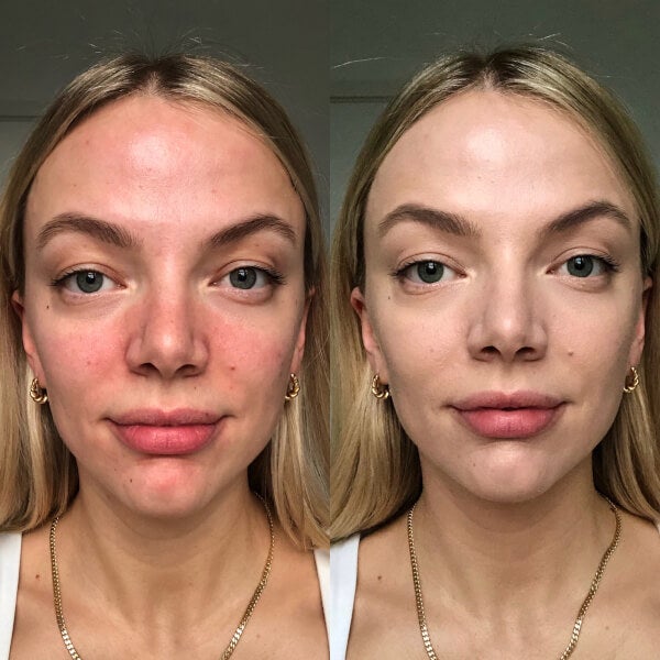 Dr.Jart+ Dr.Jart+ Cicapair Tiger Grass Color Correcting Treatment 15ml Sostegno trimestrale