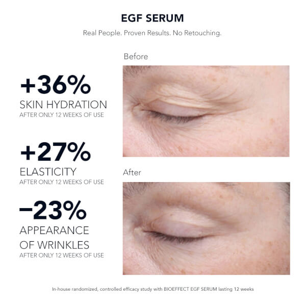 BIOEFFECT BIOEFFECT EGF Serum 15ml Offerta speciale
