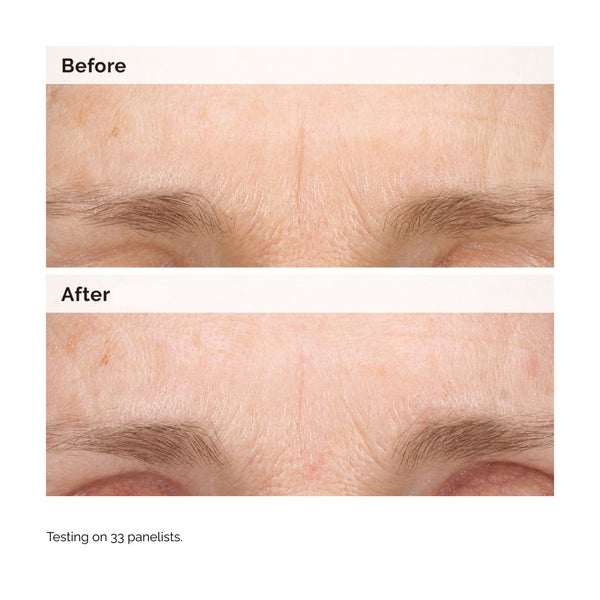 The Ordinary The Ordinary Retinal 0.2% Emulsion 15ml Fino Al -60%
