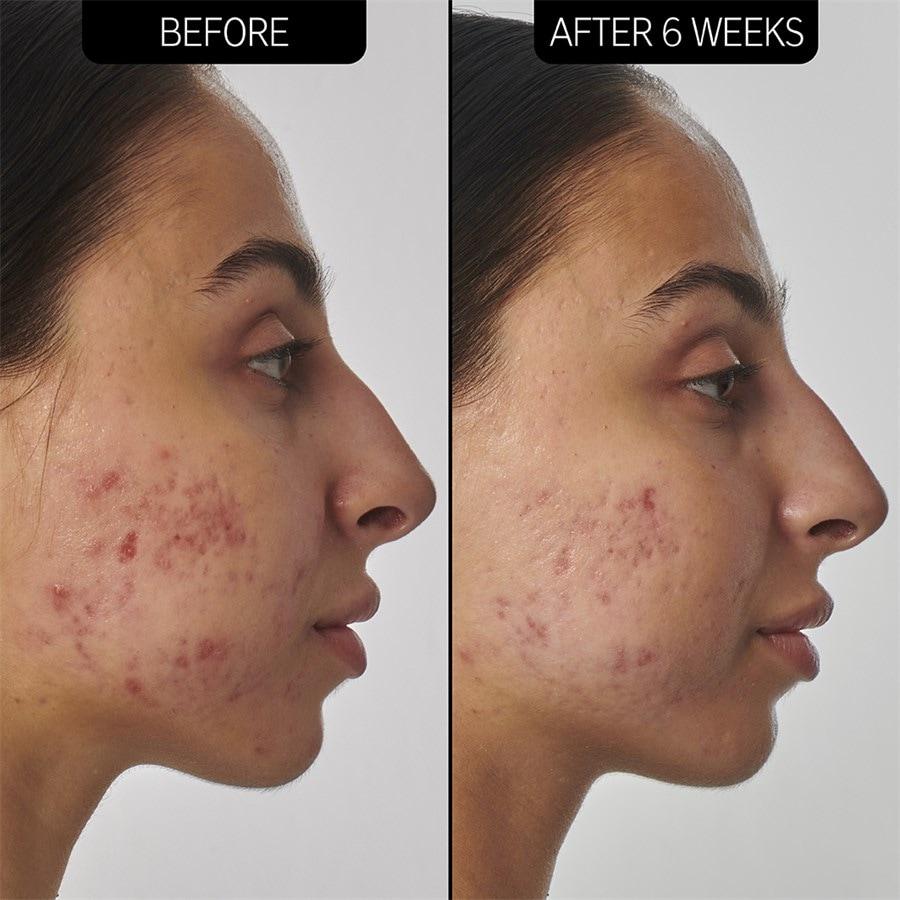 The INKEY List Sieri SuperSolutions 1% Retinol Serum Convenienza