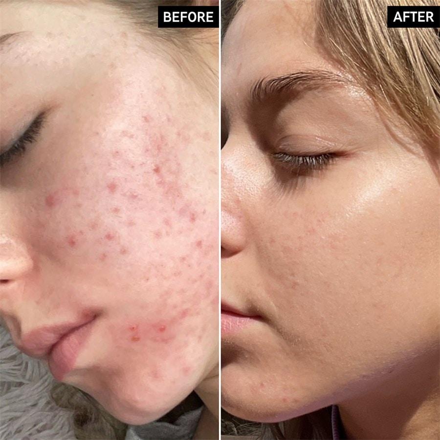 The INKEY List Sieri Niacinamide Serum Enormi sconti
