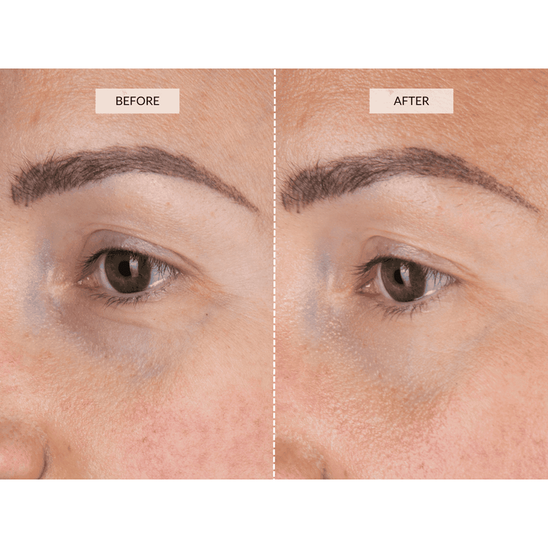 CurrentBody Skin LED Eye Perfector Shopping Online