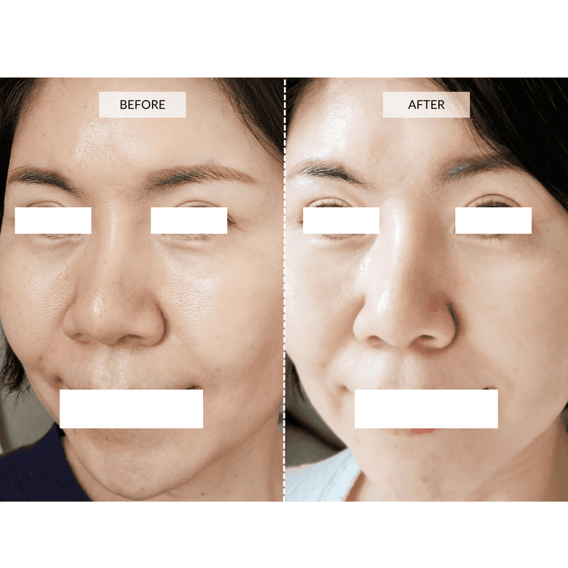 CurrentBody Skin Maschera viso LED 4-in-1 con mappatura a zone Currentbody Skin Saldi