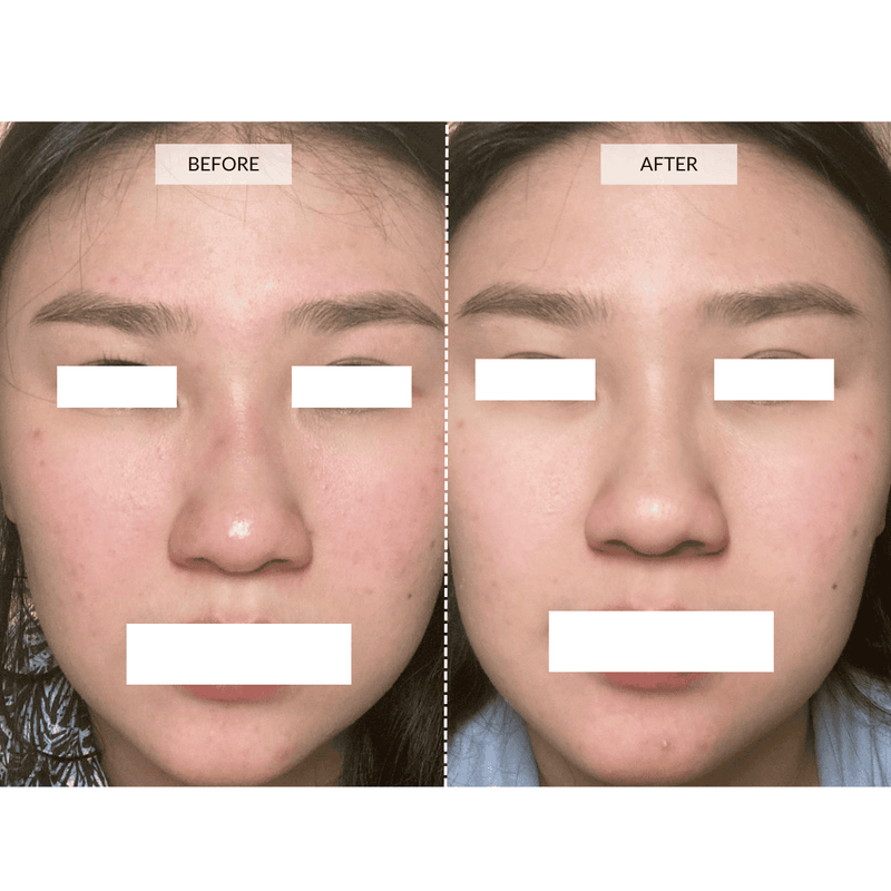CurrentBody Skin Maschera viso LED 4-in-1 con mappatura a zone Currentbody Skin Saldi