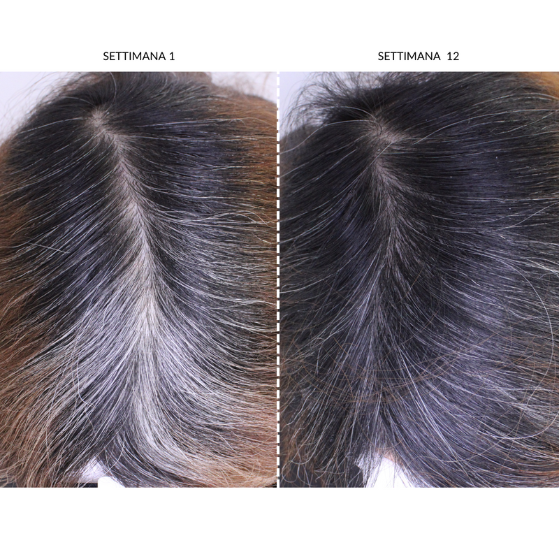 CurrentBody Skin Dispositivo LED Per la Ricrescita dei Capelli Hotsell