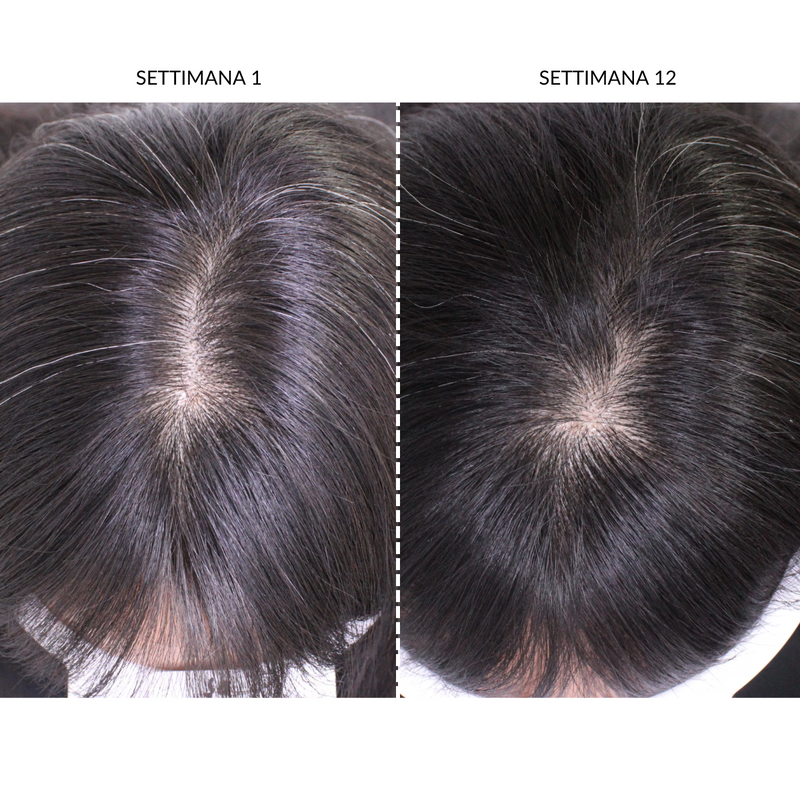 CurrentBody Skin Dispositivo LED Per la Ricrescita dei Capelli Hotsell