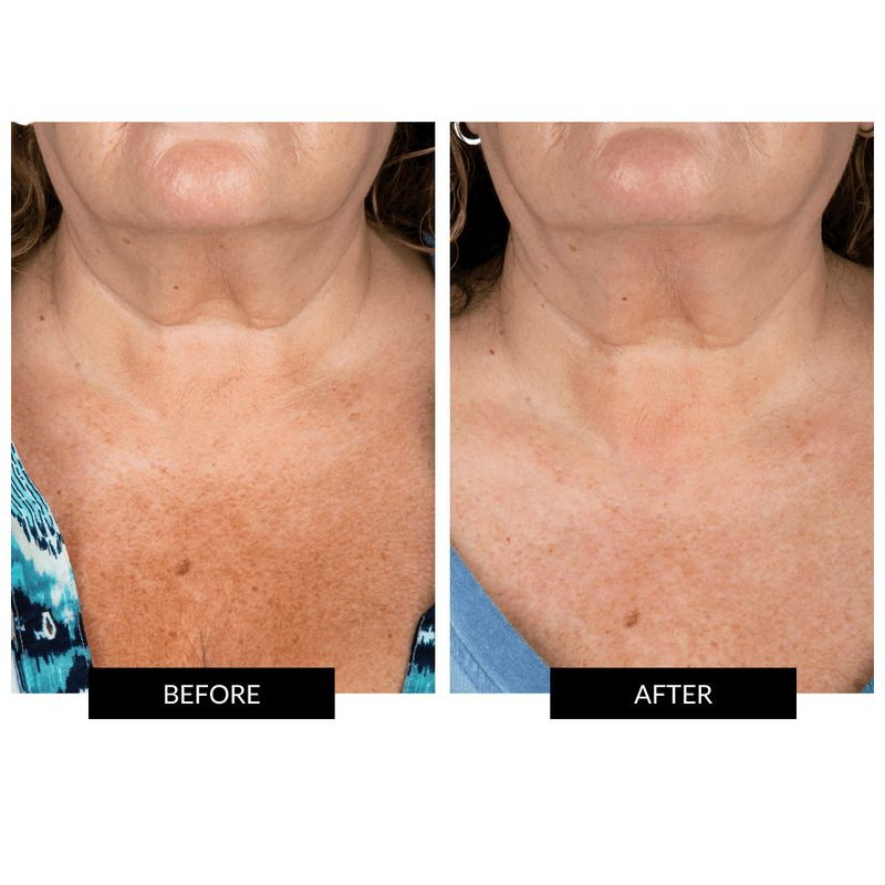 CurrentBody Skin Maschera Collo e Décolleté Vendita Economica