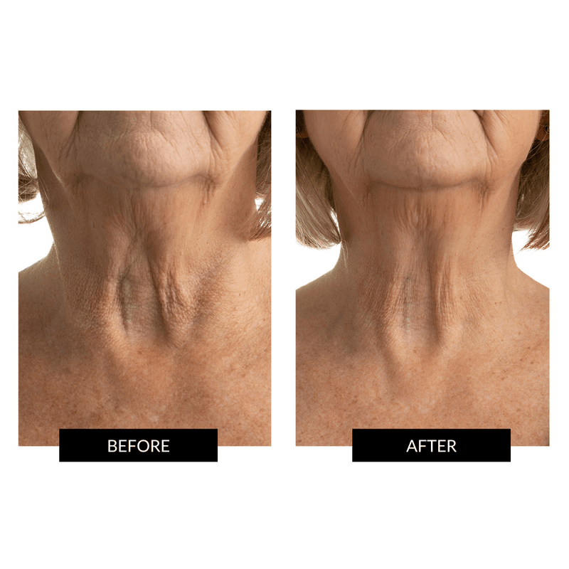 CurrentBody Skin Maschera Collo e Décolleté Vendita Economica