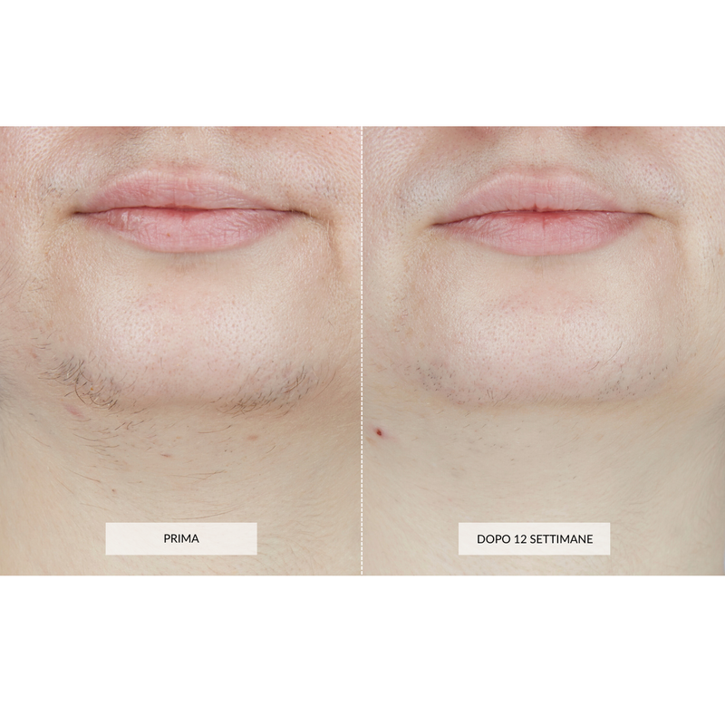 CurrentBody Skin Dispositivo di Epilazione Laser Negozio
