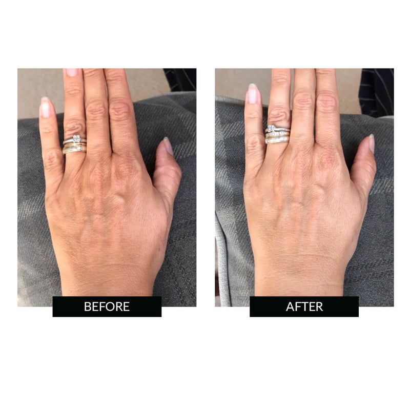 CurrentBody Skin Offers CurrentBody Skin LED Hand Perfector Offerta 2025