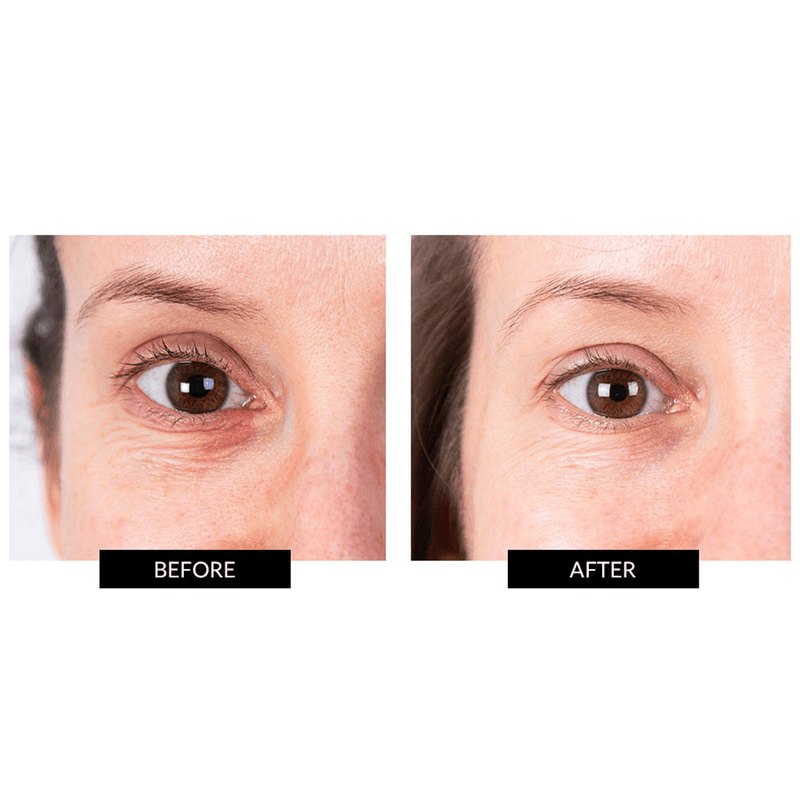 CurrentBody Skin LED Eye Perfector & 5 Eye Hydrogel Masks (del valore di 249€) Pezzi Unici
