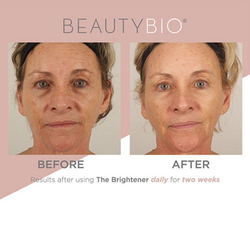 BeautyBio The Brightener In Linea