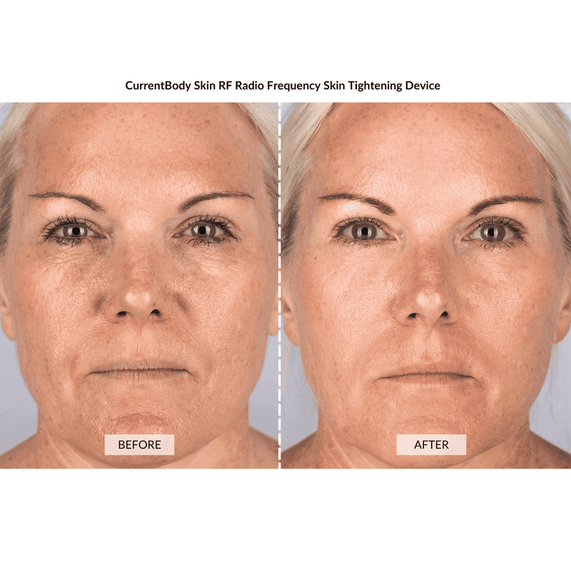 CurrentBody Skin Kit Viso Anti-età completo Presa