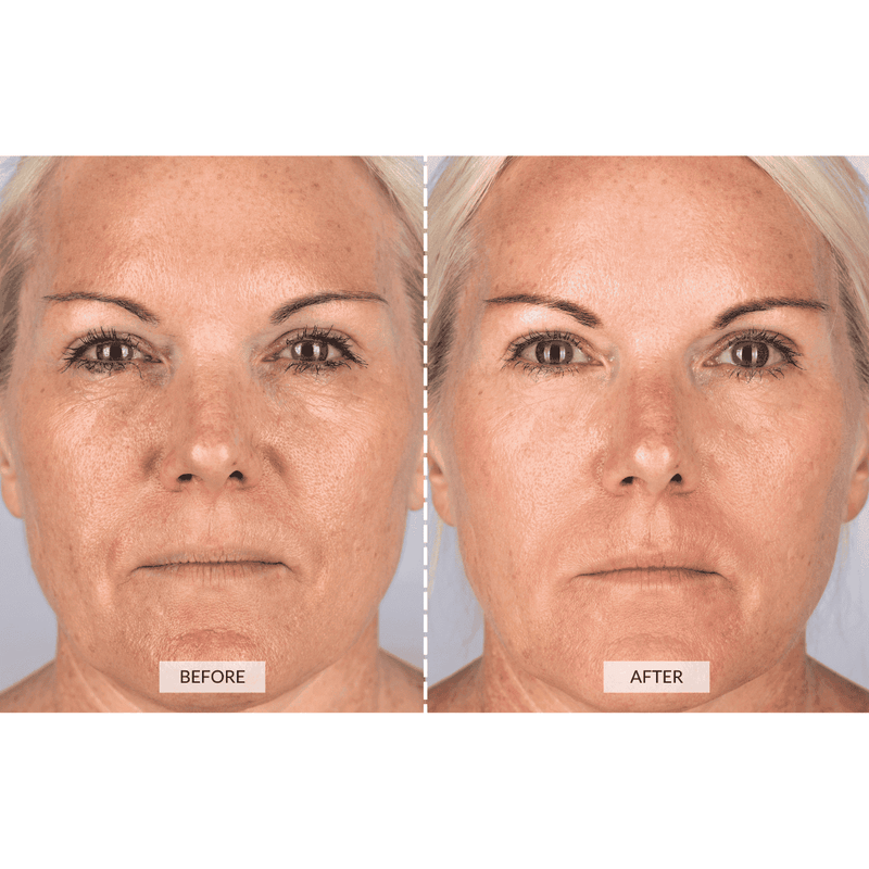 CurrentBody Skin Dispositivo a radiofrequenza RF x Sonia Sélaire Offerta