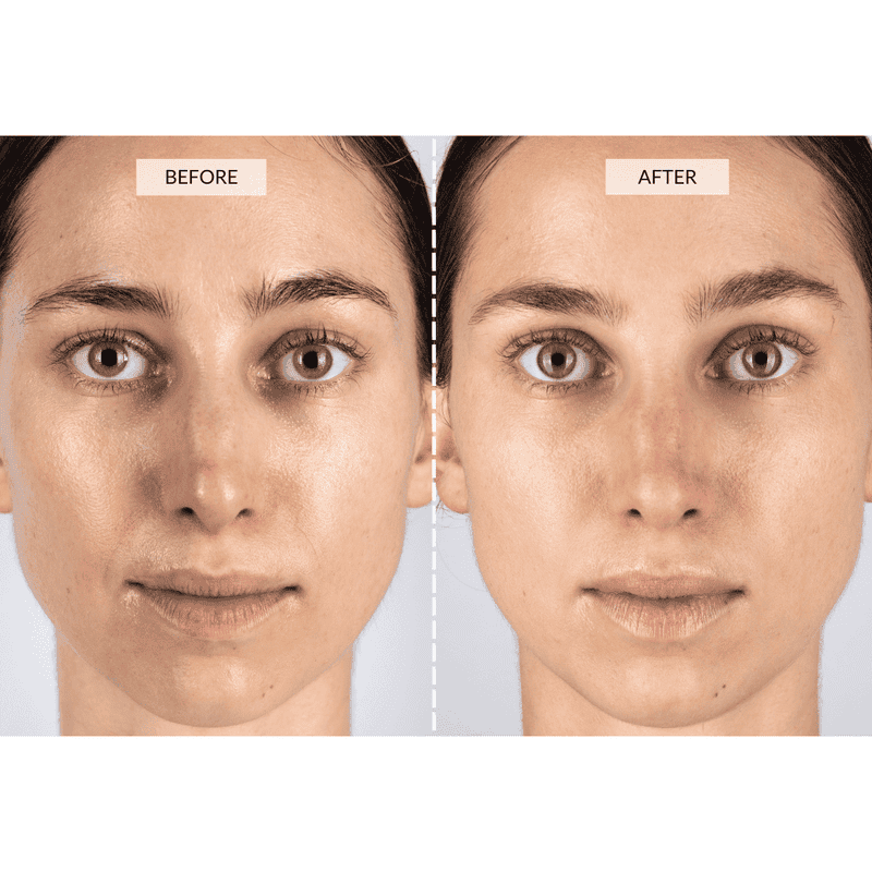 CurrentBody Skin Set Regalo Beauty LED Qualità