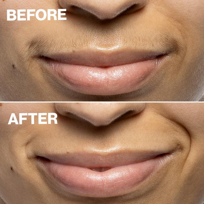 DERMAFLASH Dispositivo di Epilazione Mini Precision Peach Fuzz Acquista Ora