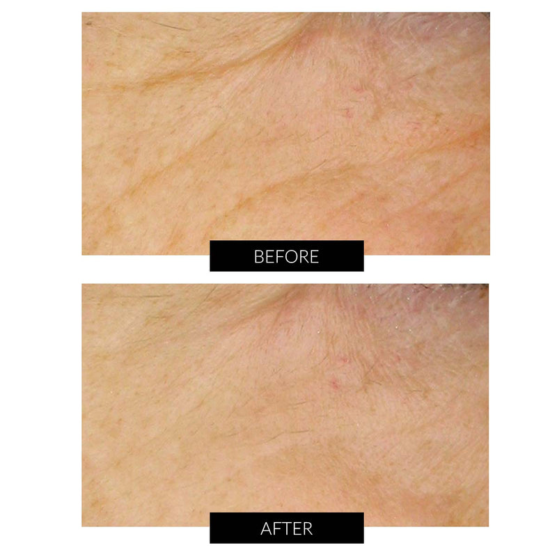 Dr Levy Set Stem Cell Miracle Trial (del valore di 495€) Negozio