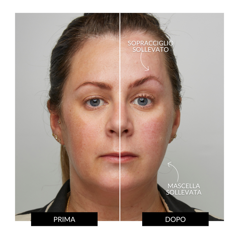 CurrentBody Skin Offers Dispositivo Tonificante Facciale ZIIP HALO Offerta Fino Al -60%