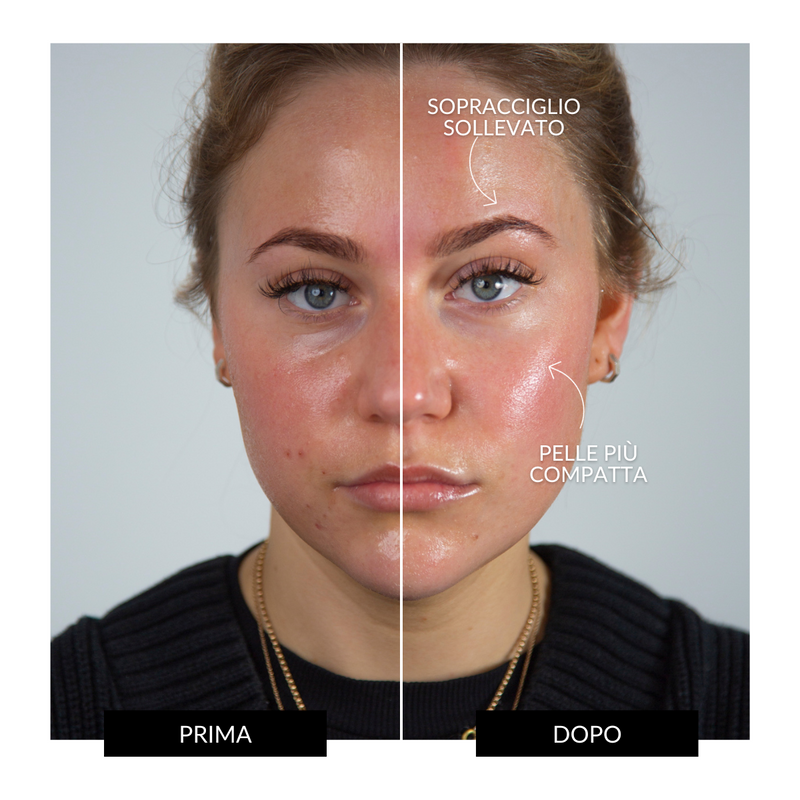 CurrentBody Skin Offers Dispositivo Tonificante Facciale ZIIP HALO Offerta Fino Al -60%