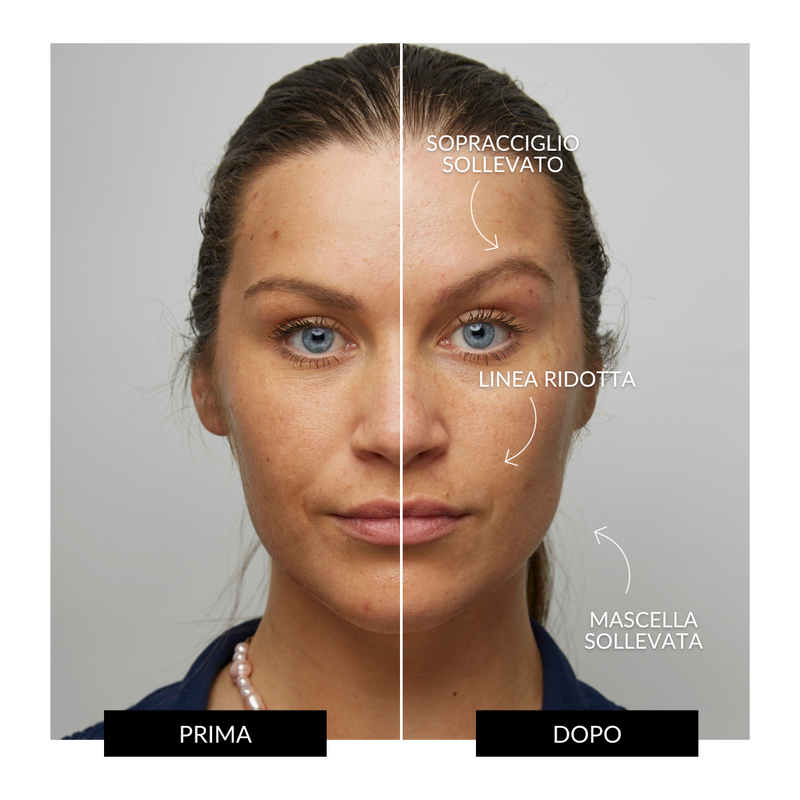 CurrentBody Skin Offers Dispositivo Tonificante Facciale ZIIP HALO Offerta Fino Al -60%