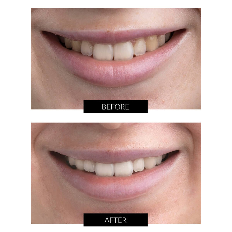 CurrentBody Skin Offers CurrentBody Skin Kit Sbiancamento Denti LED Offerta 2025