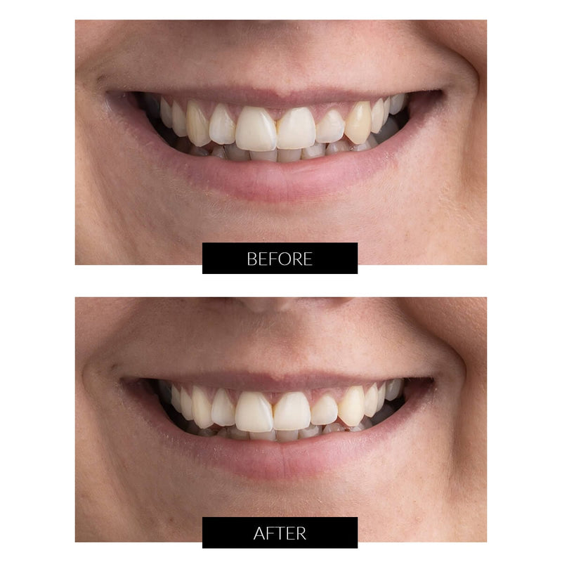 CurrentBody Skin Offers CurrentBody Skin Kit Sbiancamento Denti LED Offerta 2025
