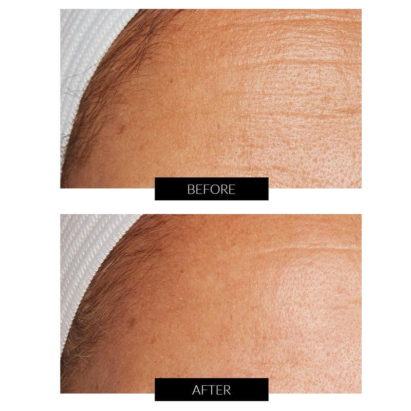 Lancer Skincare The Method: Nourish Normal-Combination Skin (50ml) Acquista Ora