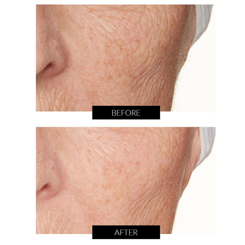 Lancer Skincare The Method: Nourish Normal-Combination Skin (50ml) Acquista Ora