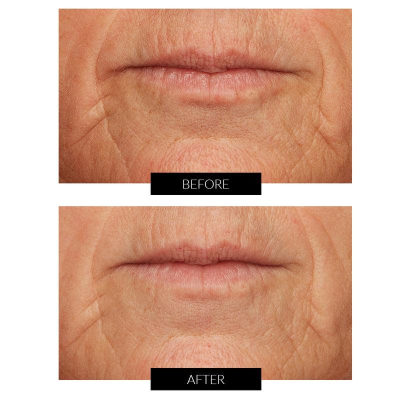 Lancer Acid Peel al Limone Caviale con Acido Glicolico (50ml) Sottocosto