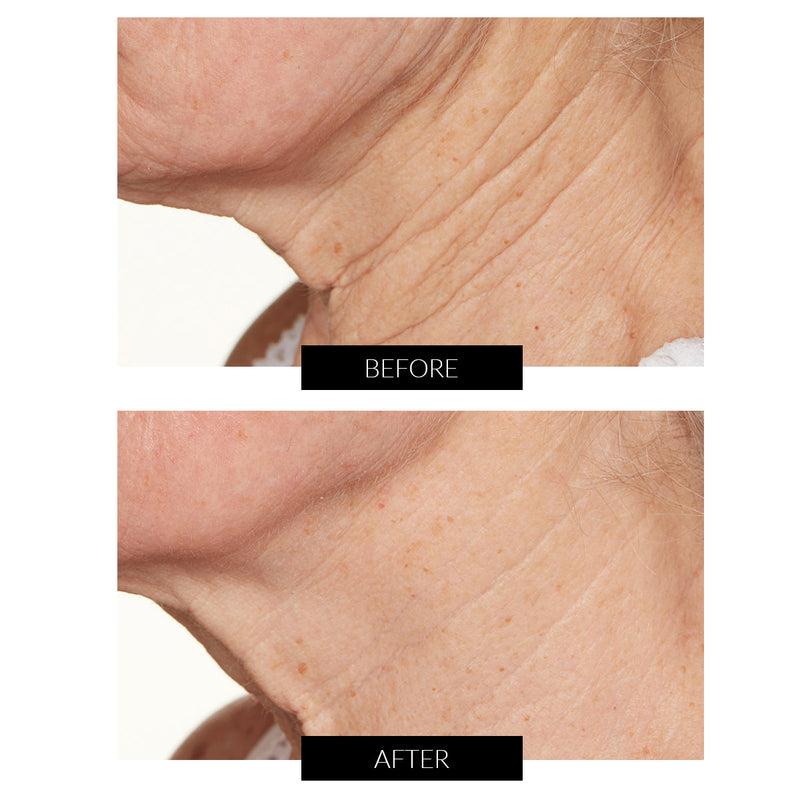 Lancer Skincare Trattamento Notte Intensivo con Hylaplex e Olio di Marula (50ml) Presa